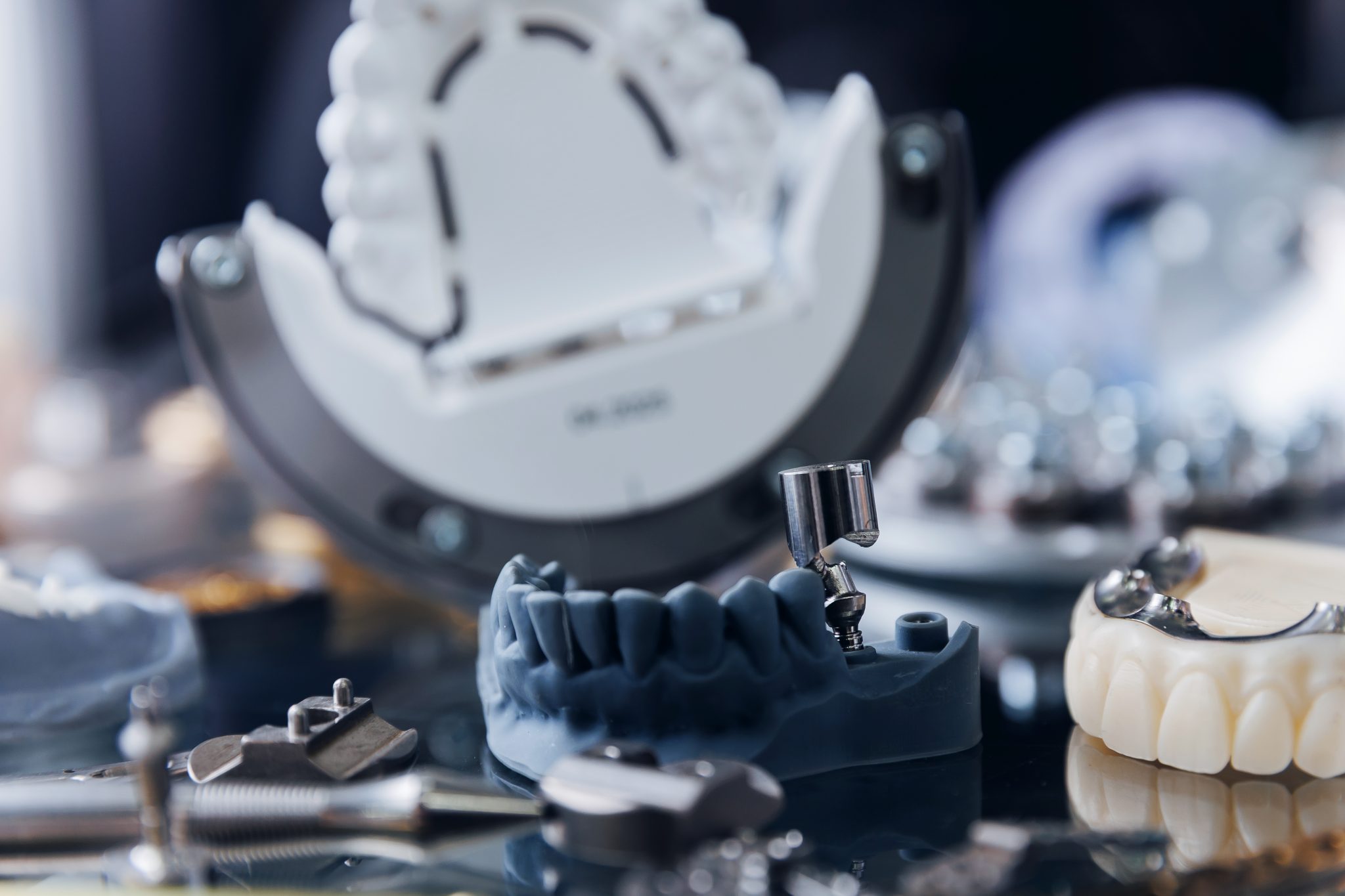 Dental Lab Services | CAD/CAM, Implants & Restorations